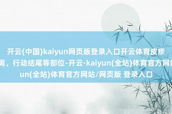 开云(中国)kaiyun网页版登录入口开云体育皮疹多散布在口周、肛周、行动结尾等部位-开云·kaiyun(全站)体育官方网站/网页版 登录入口